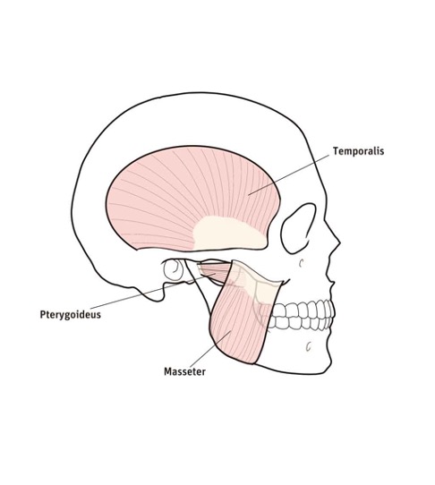 Kieferbeschwerden und Craniomandibuläre Dysfunktion (CMD) durch Bruxismus – Grafik: N. Römer